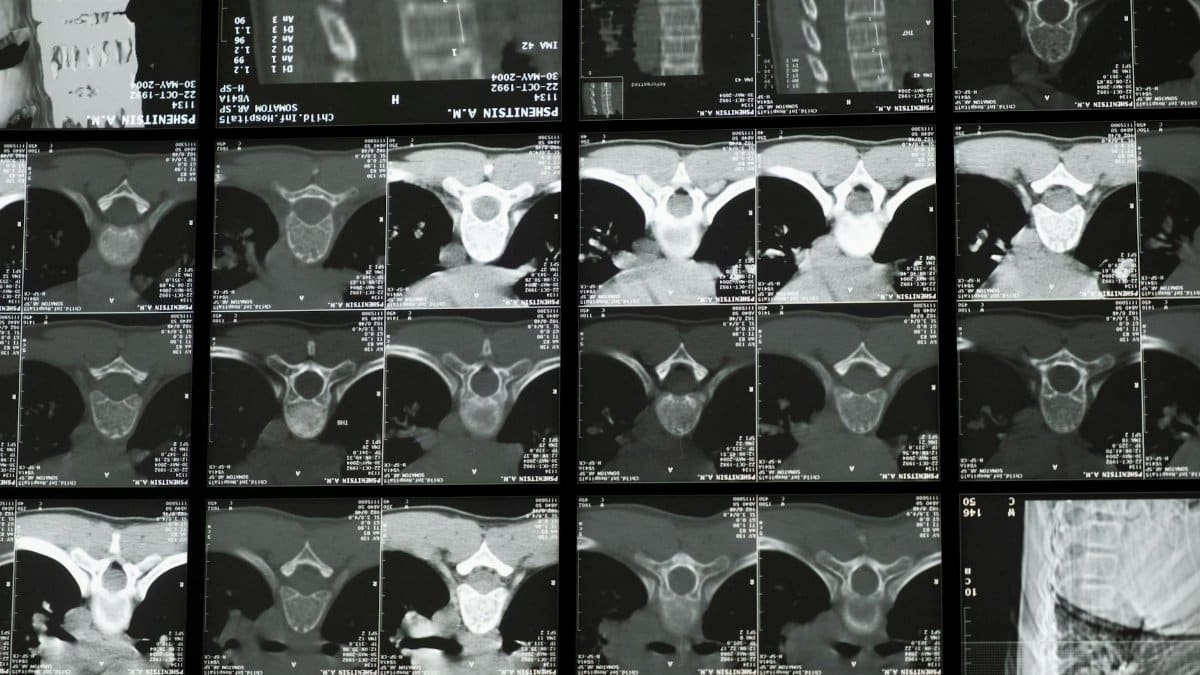 High-resolution radiological images showcasing the complex structure of the human spine for medical examination.