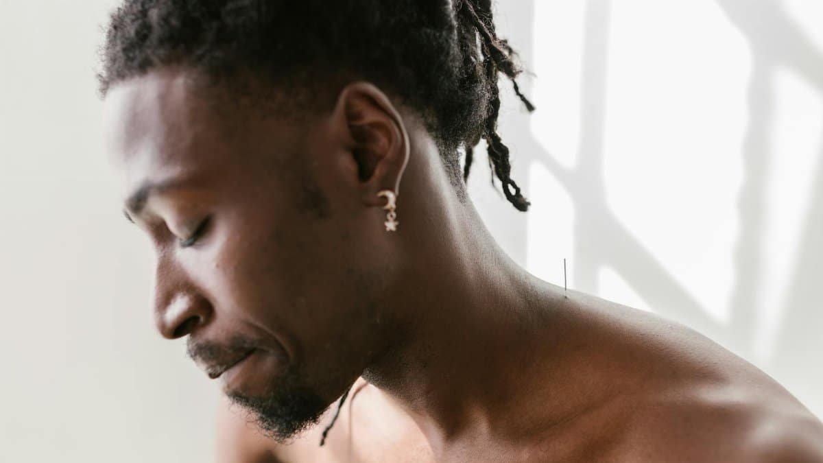 A serene black man receives acupuncture treatment for holistic wellness indoors.