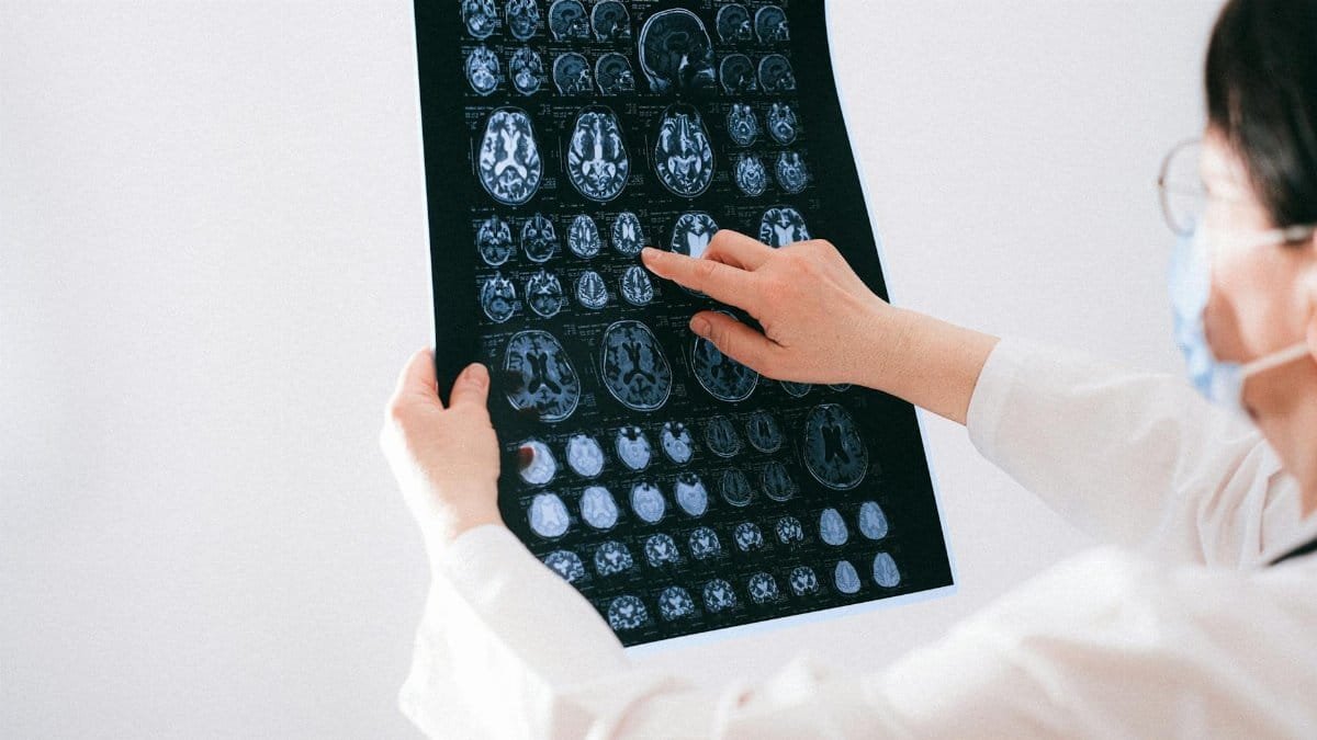 Doctor examines brain MRI scans closely for medical diagnosis in a hospital environment.