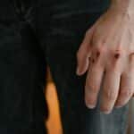 Detailed image of a hand with visible wounds and scratches, emphasizing injury.