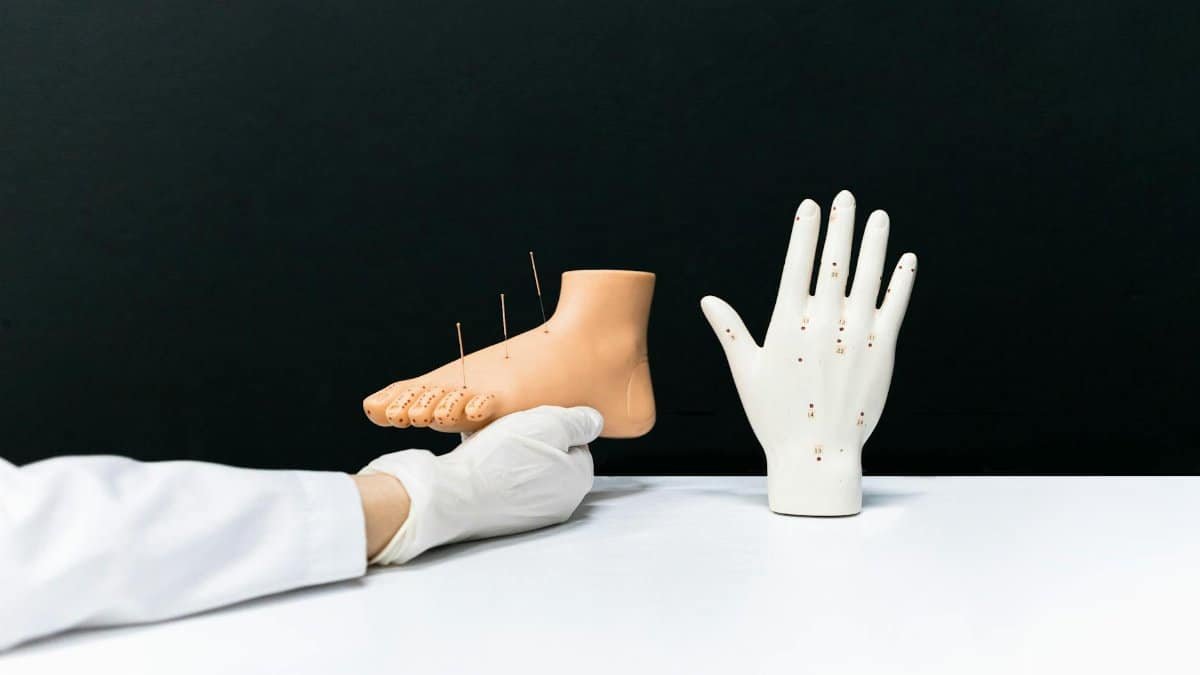 Acupuncture hand and foot models with needles for alternative therapy training.