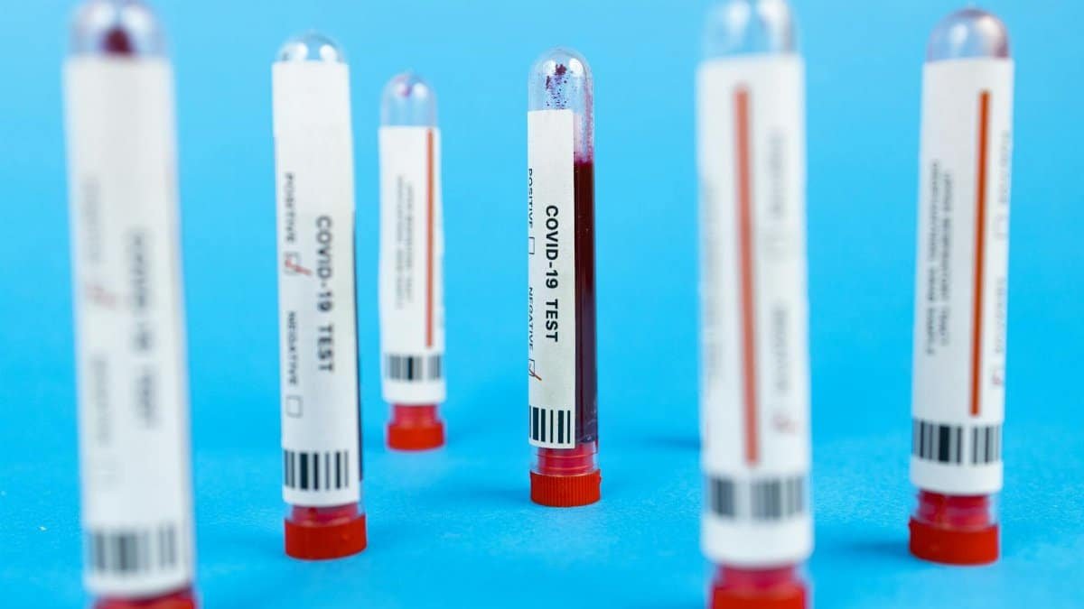 Close-up of COVID-19 blood test tubes on blue background, representing pandemic testing.