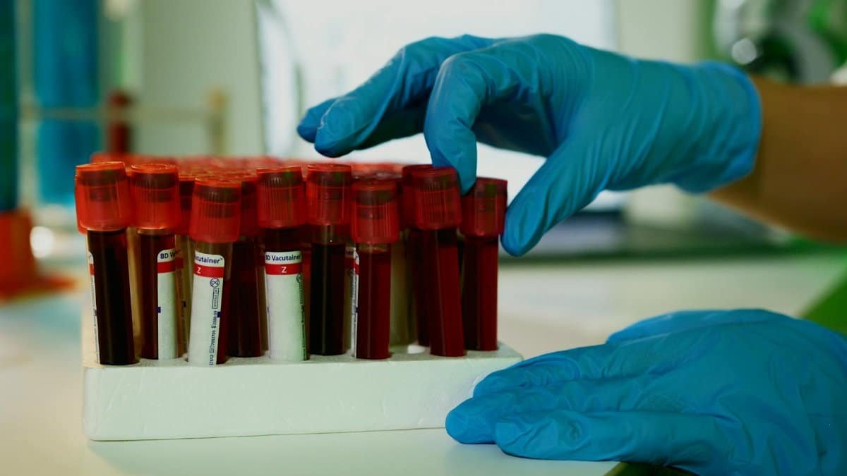 A lab technician handles blood vials in a laboratory setting, showcasing medical research.