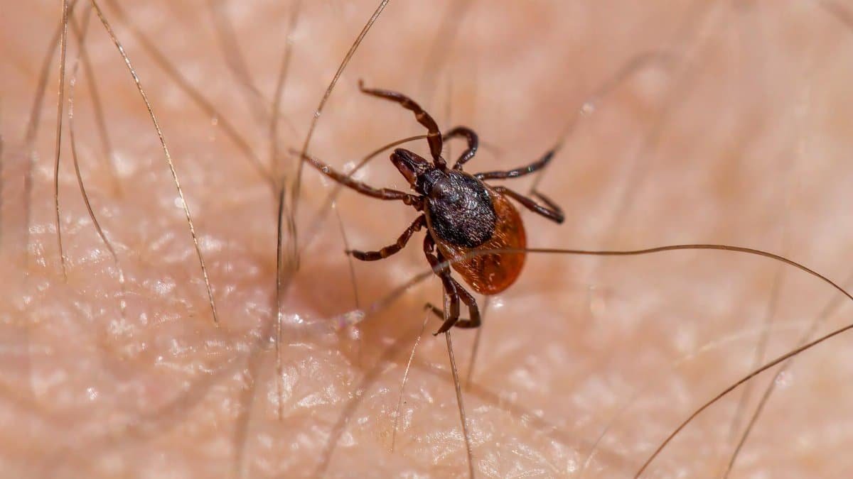 Close-up image of an Ixodes ricinus tick on human skin, illustrating its potential health risks.