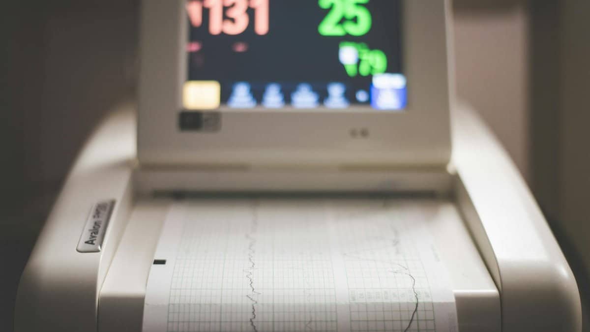 Detailed image of an electronic fetal monitoring machine showing heart rate and contraction data.